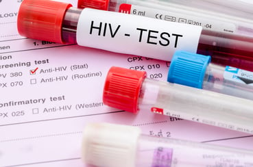Riesgos para los pacientes con VIH: los viajes o el turismo